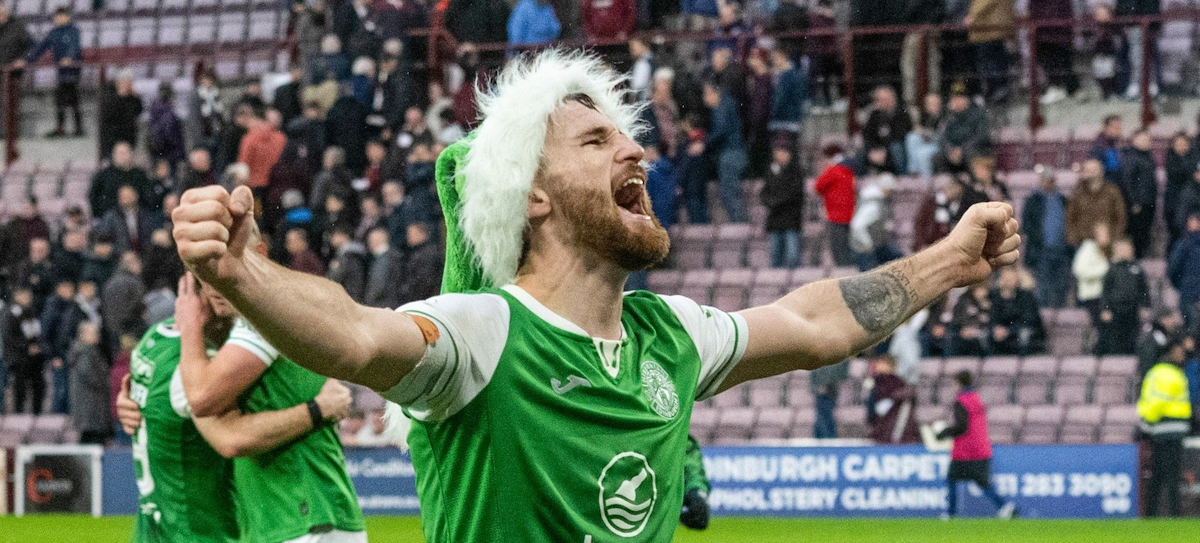 Hibernian. Source: Official Facebook