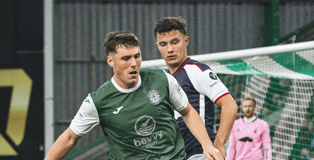 Hibernian. Source: Official Facebook. Edited photo