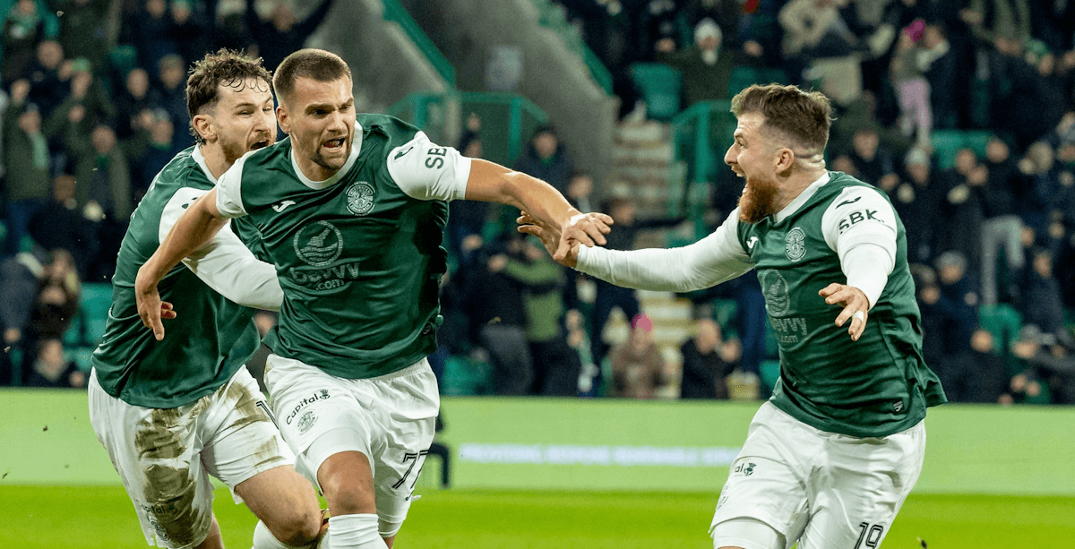 Hibernian. Source: Official Facebook. Edited photo